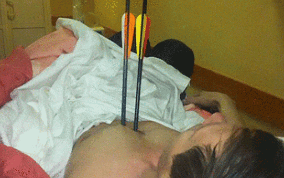 True Story: A Russian Guy Shot Himself TWICE with a Crossbow and Survived